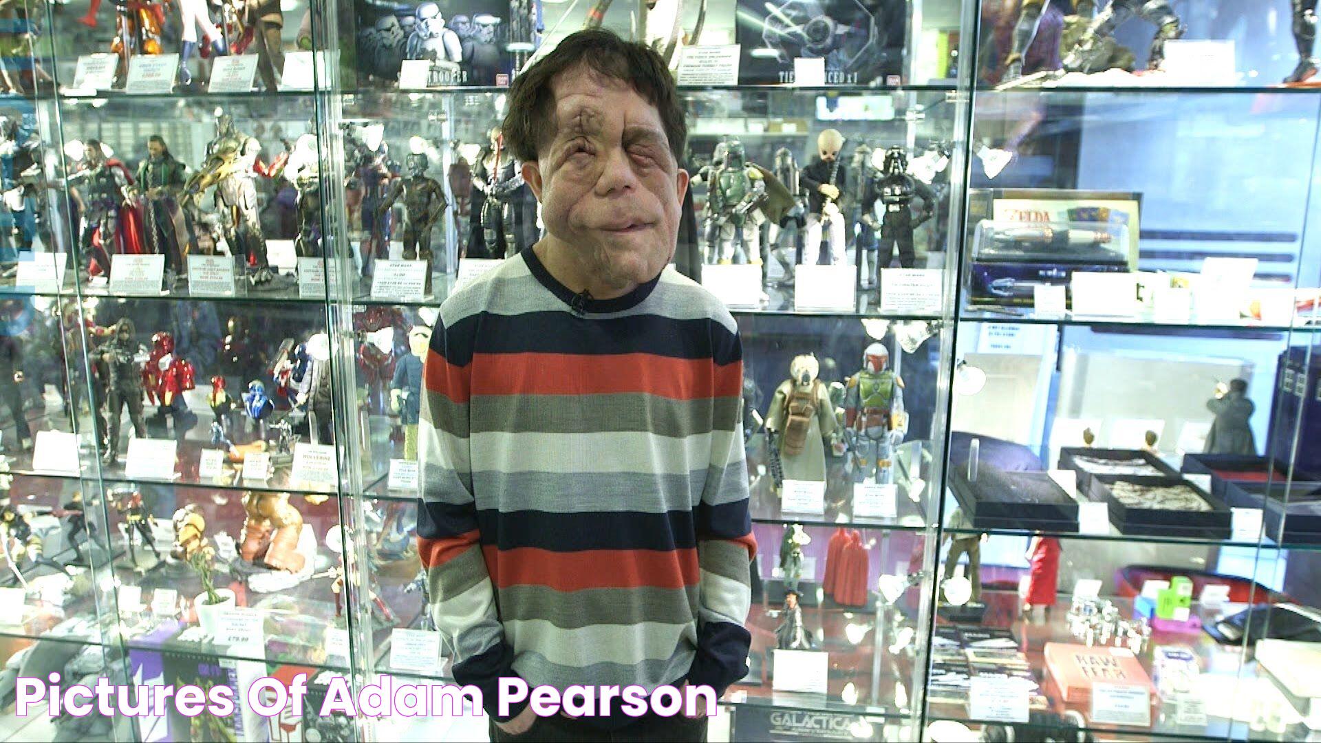 Pictures of Adam Pearson