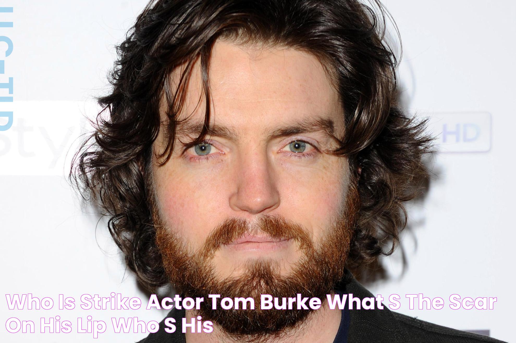 Who is Strike actor Tom Burke, what's the scar on his lip, who's his