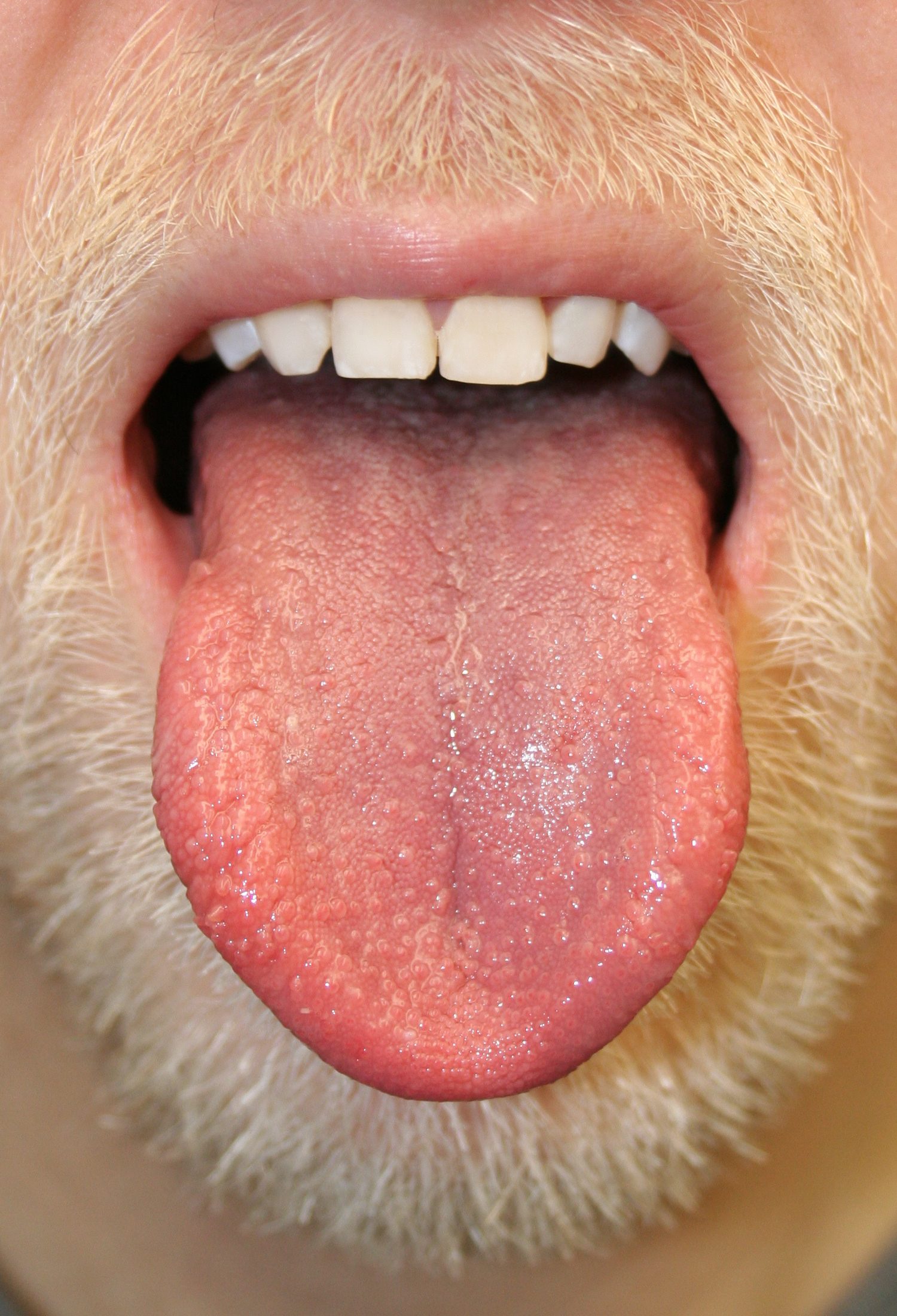 Exploring The Benefits Of Putting Salt Under Your Tongue